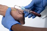 Drawing blood into a tube for ActiGraft preparation